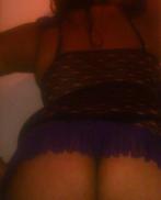 LudmilaAmpliación de mama