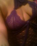 LudmilaAmpliación de mama