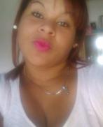 LudmilaAmpliación de mama